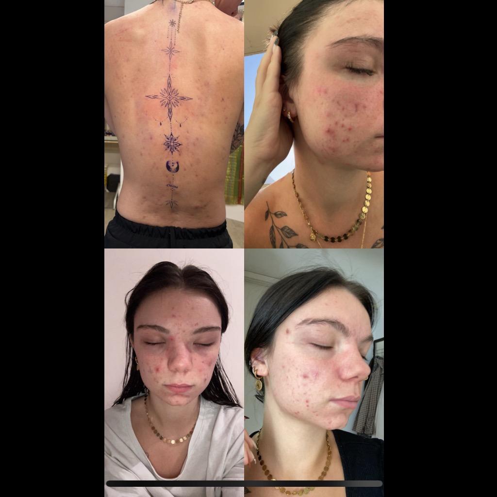 Înainte de utilizare Secret Ten Prețios  Cremă fără Ulei  Masca Oxy-Minerală cu Ceară...  Cremă Prețioasă cu Lapte de...  Pinup-Secret