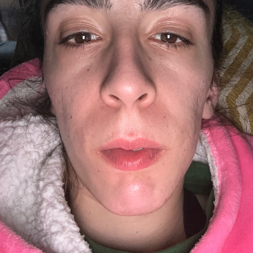 După utilizare Secret Ten Prețios  Pinup-Secret