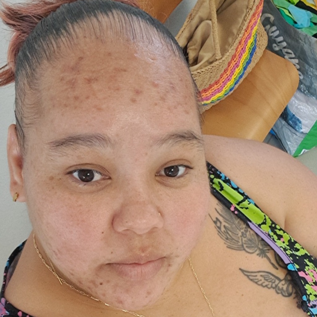 Înainte de utilizare Secret Ten Prețios  Cremă Prețioasă cu Lapte de...  Cremă fără Ulei  Brumă Grădina Edenului  Pinup-Secret